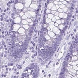 VIAAT/SLC32A1/VGAT Antibody, Novus Biologicals:Antibodies:Primary Antibodies